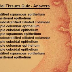 Tissue identify class example each belongs which connective muscle epithelial nervous question answer transcribed text show been has