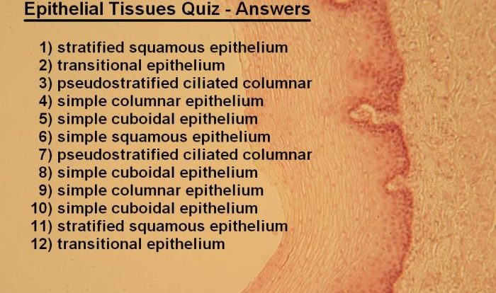 Tissue identify class example each belongs which connective muscle epithelial nervous question answer transcribed text show been has