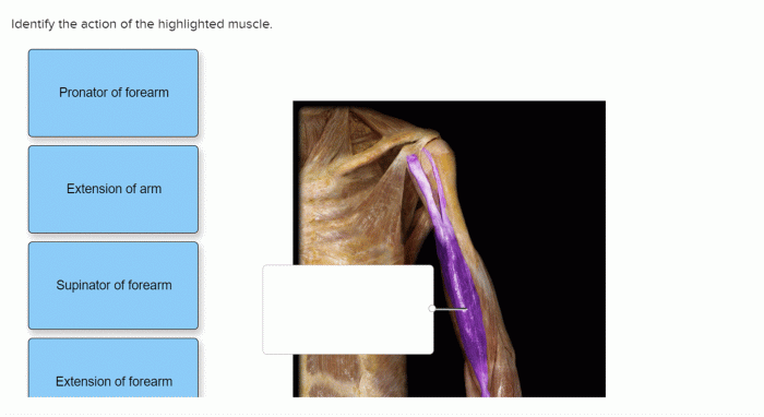 Identify the action of the highlighted muscle.