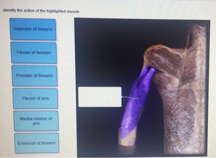 Identify the action of the highlighted muscle.