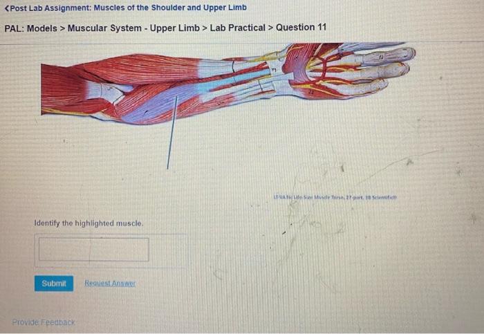 Muscle highlighted lt solved which