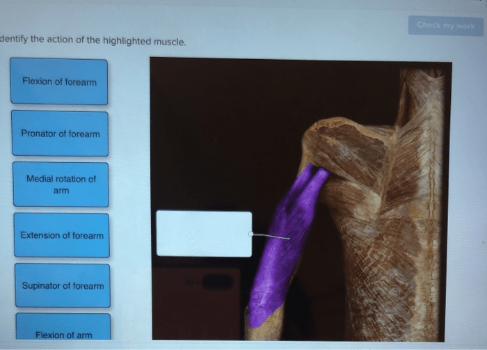 Highlighted muscle transcribed